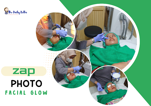 photo facial glow ZAP