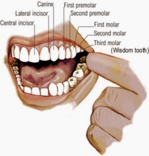 Cara Trasidional Mengobati Sakit Gigi yang Ampuh