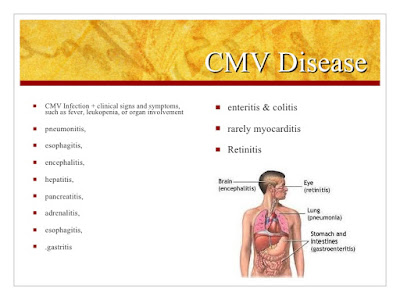  CMV infection treatment dr senthil kumar panruti chennai