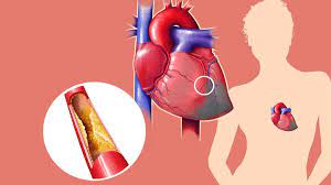 Cholesterol Facts