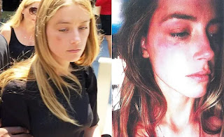 The chilling photos of the blows and injuries caused by Johnny Depp and Amber Heard