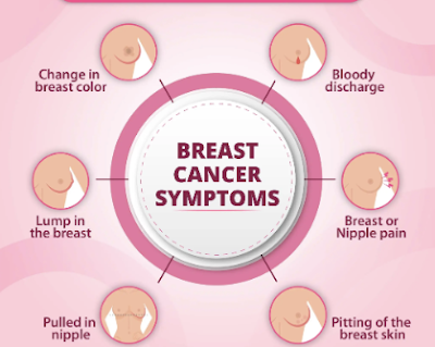 Breast cancer symptoms, causes and treatment