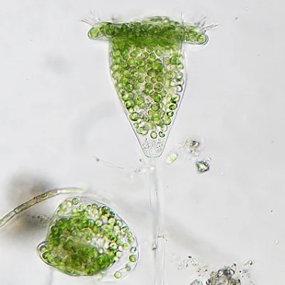 Deskripsi, Reproduksi dan Contoh Protista Mirip Hewan Sub Bab Ciliata 