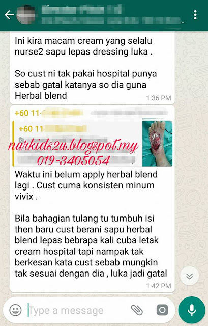 testimoni diabetes vivix