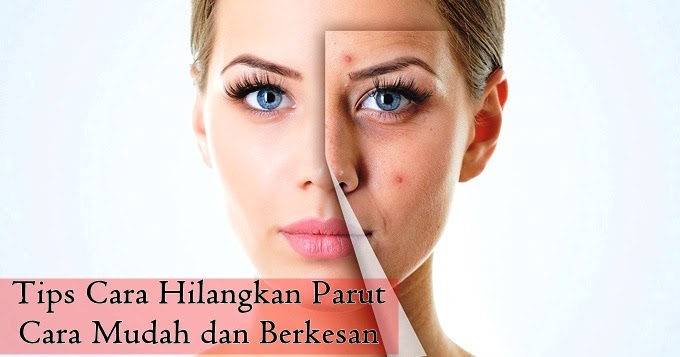 Ubat Hilangkan Parut Hitam Di Kaki - Perubatan s