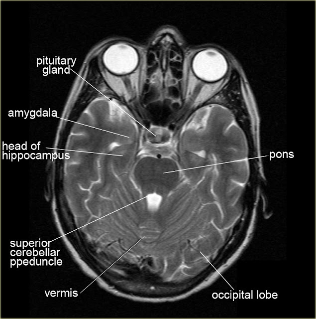 Brain Radiology2