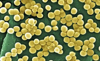 Careful, Super Bacteria Threaten World Health