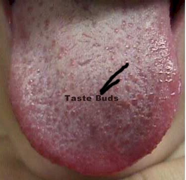 White taste buds - ask.com Answers.com - what causes white sore inflamed 