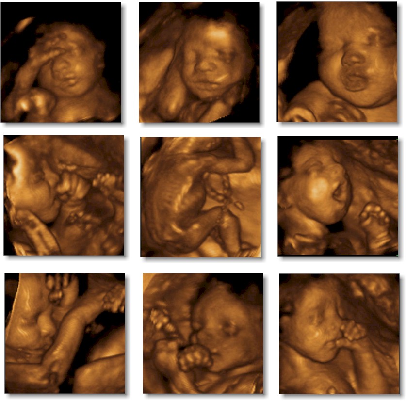 3d Ultrasound Pregnancy :: 3d Puzzle Image