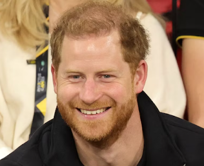 prince harry hair loss