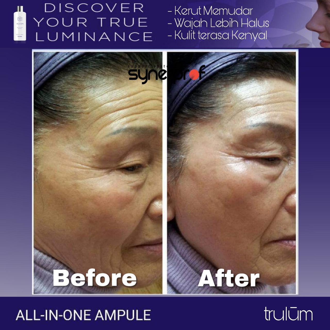Jual Trulum All In One Ampoule Di Wilayah Luhak Nan Duo, Pasaman Barat WA: 08112338376 Jual Trulum All In One Ampoule Di Wilayah Luhak Nan Duo, Pasaman Barat WA: 08112338376