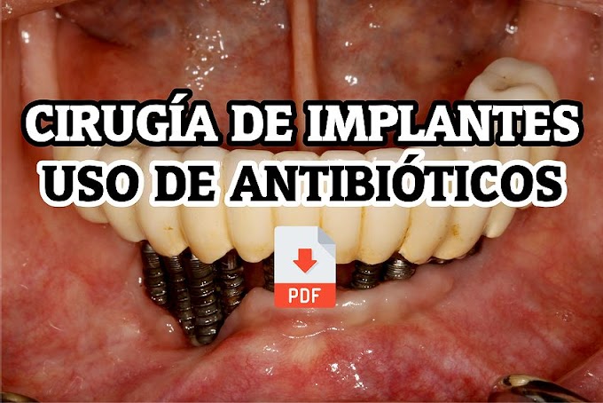 PDF: Uso de Antibióticos en Cirugía de Implantes: Una Revisión Sistemática 