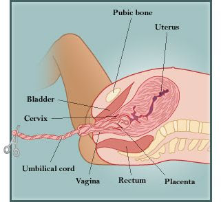 baby-delivery-pregnancy2