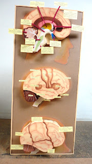 Cerebro