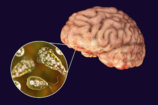 Brain eating Amoeba in microscope