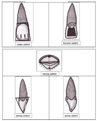 Permanent maxillary central incisors l tooth crown & root morphology revision