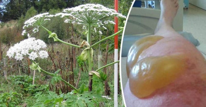 If You See This Plant, Don't Touch It, It Can Cause Burns And Blindness