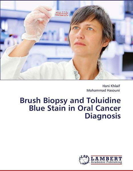 BOOK: Brush Biopsy and Toluidine Blue Stain in Oral Cancer Diagnosis - Khlaif Hani and Hasouni Mohammad