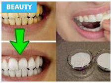 GUARANTEED! WHITEN YOUR YELLOW TEETH IN LESS THAN 2 MINUTES