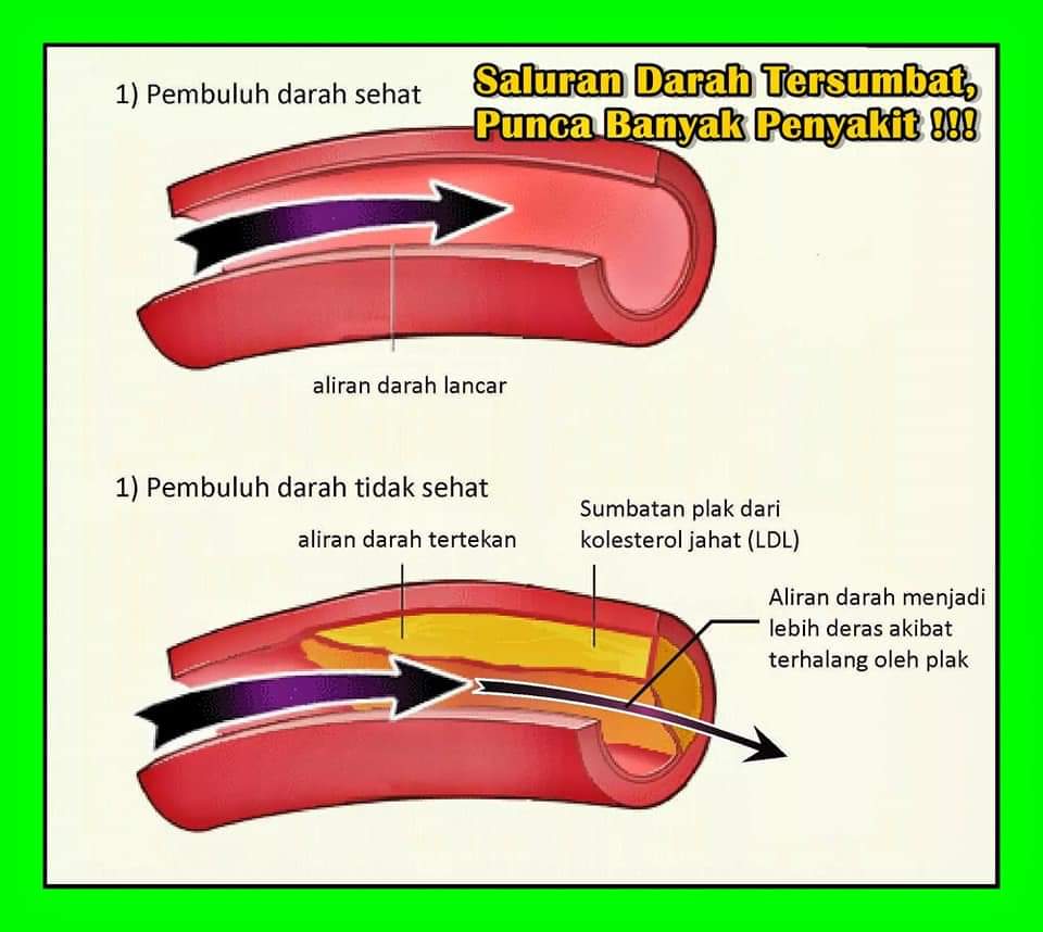 testimoni vken