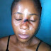 Angry Lecturer Injures Female Student For This Reason 