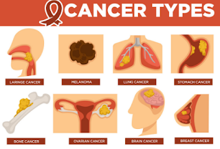 What are 5 main types of cancer?