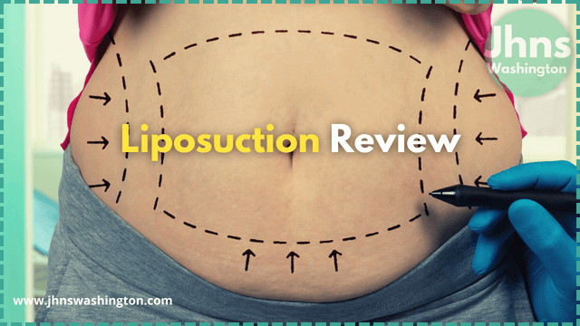 Liposuction for obese