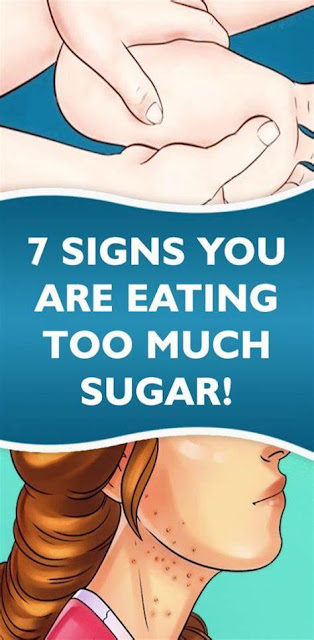 7 Signs You Are Eating Too Much Sugar