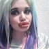 Bulgarian Woman Addicted To Lip Fillers Quadruples The Size Of Her Natural Lips