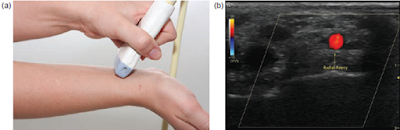 Ultrasound Artifacts