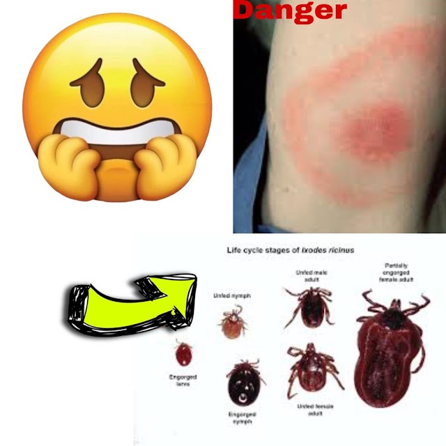 What is Lyme disease and Lyme sickness?