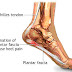 3 Things I Learned About Heel Pain