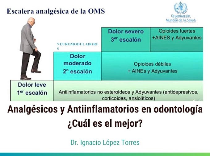 WEBINAR: Analgésicos y Antiinflamatorios en odontología ¿Cuál es el mejor? - Dr. Ignacio López Torres