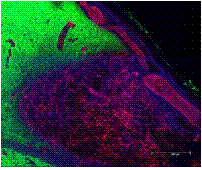 picture of hydrogel treatment