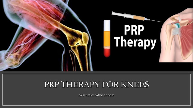 PRP therapy