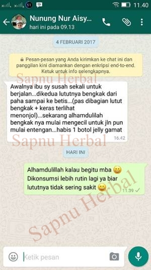 Obat Kaki Bengkak Karena Jatuh Kecelakaan, Keseleo, Benturan Keras, Terkilir dan Cedera Lainnya