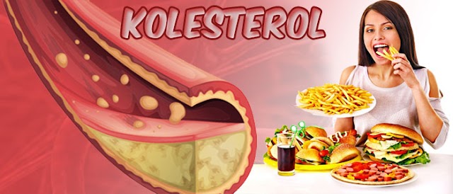 Paket Sehat Kolesterol