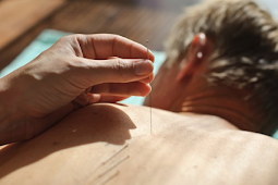 6 Complementary and Alternative Therapies for Stroke 