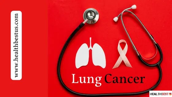 Lung Cancer | What are the various kinds in 2022 ?