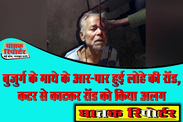 रायसेन/देवरी, बुजुर्ग के माथे के आर-पार हुई लोहे की रॉड, कटर से काटकर रॉड को किया अलग
