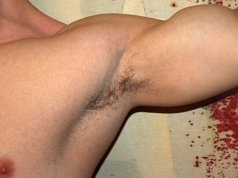 Armpit by David Shankbone Wikimedia