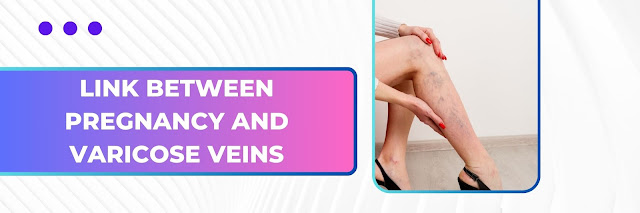 The Link Between Pregnancy and Varicose Veins