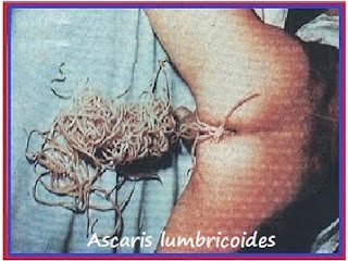 BIOLOGI GONZAGA CACING  PERUT ASCARIS LUMBRICOIDES