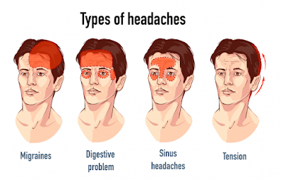 What Headache Means, Types, Symptoms And Treatments