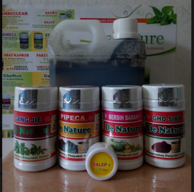 Agen Resmi De Nature Obat Herpes Zoster  Ampuh