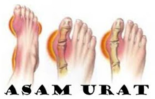 Cara Menghilangkan Asam Urat Di Kaki, Cari Obat Penyakit Asam Urat, Cara Mengobati Asam Urat Dengan Tanaman Herbal, Ramuan Tradisional Untuk Mengobati Penyakit Asam Urat, Atasi Asam Urat Alami, Cara Mengobati Asam Urat Saat Hamil, Kadar Asam Urat Normal Pada Lansia, Resep Masakan Untuk Penderita Asam Urat Dan Kolesterol Tinggi, Cara Membuat Obat Asam Urat Herbal, Obat Asam Urat Alami Tumbuhan, Jamu Tradisional Asam Urat Dan Rematik, Asam Urat Mengatasi, Apa Penyebab Asam Urat Kambuh, Manfaat Air Kelapa Ijo Untuk Asam Urat, Perbedaan Asam Urat Dan Batu Ginjal, Asam Urat Dn Obatnya, Askep Asam Urat Menurut Nanda Nic Noc, Buah Hindari Asam Urat, Asam Urat Dan Penyebabnya, Cara Mengobati Asam Urat Dgn Cepat, Apakah Penyakit Asam Urat Itu Berbahaya, Efek Kopi Asam Urat, Obat Generik Penghilang Nyeri Asam Urat, Cara Mengobati Asam Urat Dengan Lobak, Resep Obat Penyakit Asam Urat, Asam Urat Olahraga, Kadar Asam Urat Normal Pada Ibu Hamil, Tanaman Herbal Yg Bisa Mengobati Asam Urat, Lauk Untuk Penderita Asam Urat Dan Kolesterol, Obatnya Asam Urat Apa 