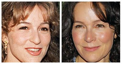 Jennifer Grey Nose Job