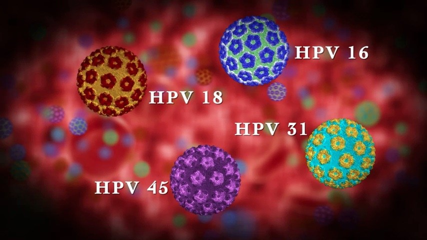 penyebab kutil HPV