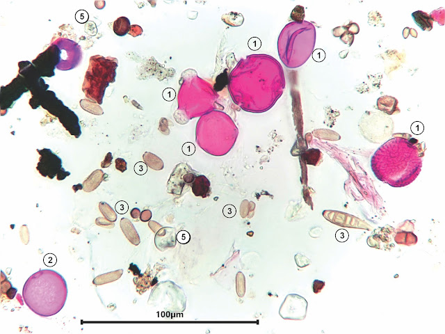 Air sample at 400x magnification showing pollen, fungal spores and fragments, and starch grains 03