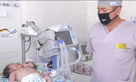 Doctors baffled as rare two-headed baby is born in Uzbekistan